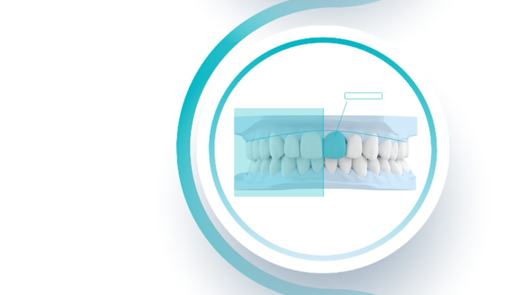 Orthodontic treatment planning